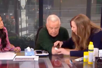 Fox Anchor Diagnosed with Skin Cancer During Live TV Segment: ‘What?!’